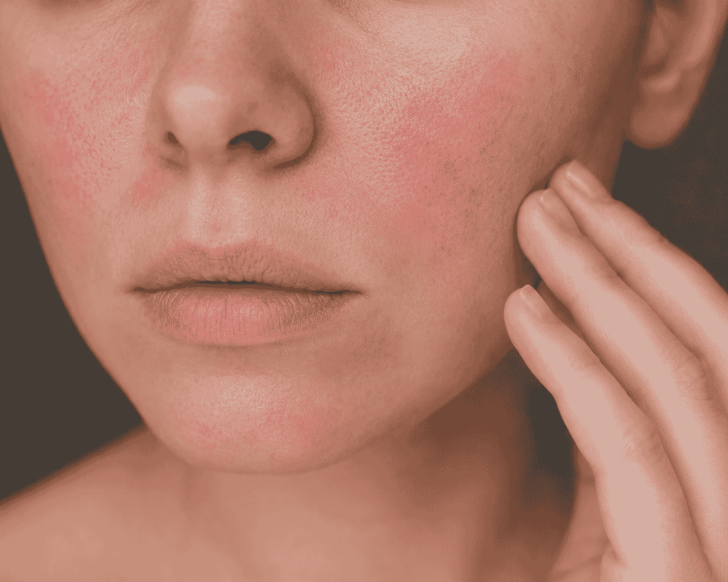 Soins naturels pour peau sensible : baume, macérat huileux et hydrolats